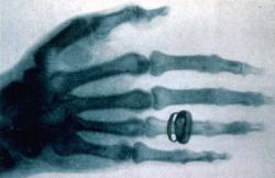 1ere radiographie 1896